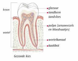 Wortelkanaalbehandeling - Gezonde kies