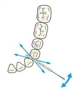 Instructie ragers
