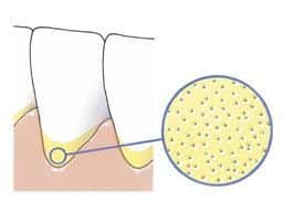 tandbeen-is-poreus